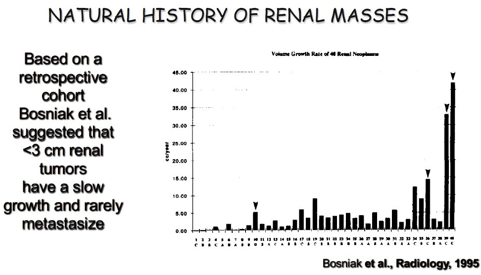 He opened by highlighting the epidemiologic shift that sparked interest in surveillance: the dramatic rise in incidentally detected renal tumors over the last 25 years, largely attributable to increased abdominal imaging. The majority of these tumors are ≤4 cm, often asymptomatic, and exhibit wide biological variability. Early radiologic and autopsy studies revealed that a substantial proportion of small renal lesions were histologically benign or indolent. Bosniak and colleagues evaluated the longitudinal behavior of small enhancing renal masses and demonstrated minimal growth over time, with many masses exhibiting growth <0.3 cm per year and exceedingly low rates of metastasis. Their observations established the initial hypothesis that tumor biology—rather than tumor presence alone—should guide management.1