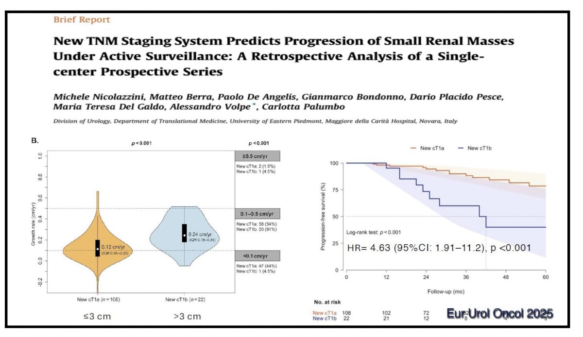 Volpe then addressed tumor size and proposed refinements to T1a staging. Emerging evidence suggests that tumors ≥3 cm behave differently during AS. Nicolai et al. demonstrated a significant association between baseline size ≥3 cm and time to progression, reporting a hazard ratio of 4.5 for progression in tumors above this threshold.9 Although size alone should not prompt automatic intervention, it supports more intensive surveillance intervals and lowers the threshold for treatment when combined with other adverse features.