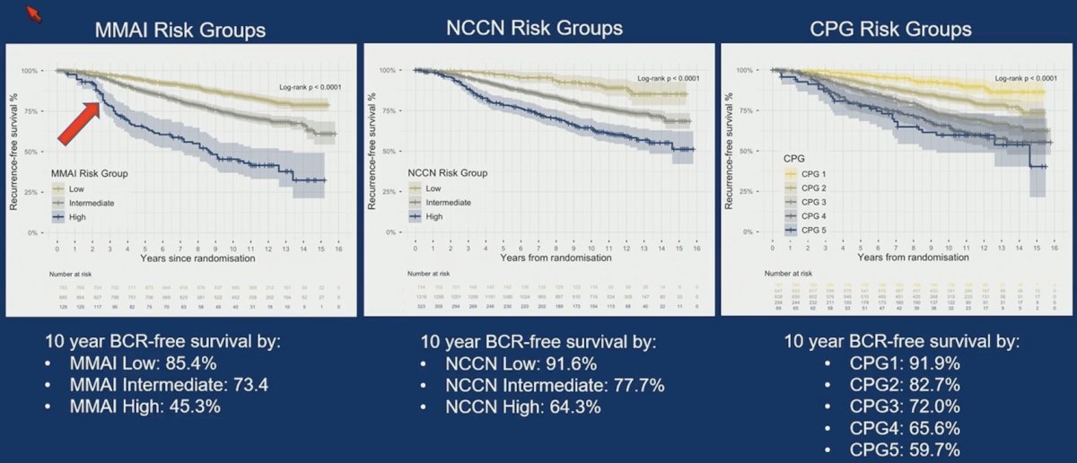 Of 1,854 patients with centrally-reviewed pathology, 1,797 (97%) had clinical data and H&E with sufficient tumour for MMAI analysis. The median follow-up was 14.3 years. Patients were classified as MMAI High (n = 129, 7.2%), Intermediate (n = 885, 49.2%), or Low (n = 783, 43.6%). In univariable analysis, high MMAI score was significantly associated with increased biochemical/clinical recurrence risk, as both a categorical variable (MMAI High risk HR 5.07, 95% CI 3.77-6.81, p < 0.001, MMAI Intermediate-risk HR 1.90, 1.52-2.36, p < 0.001), and continuous variable (MMAI raw score HR 1.55, 1.44-1.67, p < 0.001):