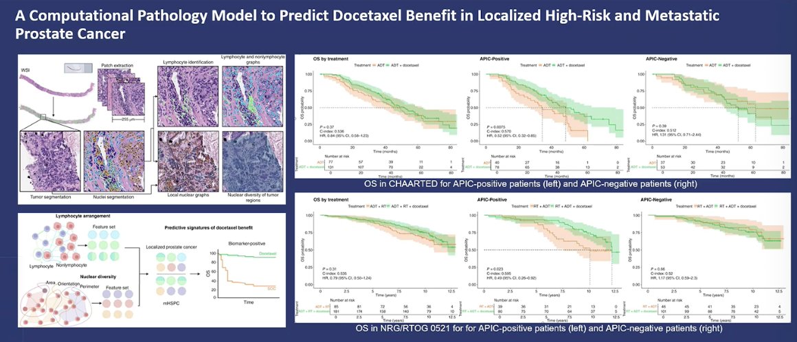 He also discussed emerging work using computational pathology to predict which patients may benefit from docetaxel. In this approach, artificial intelligence analyzes prostate biopsy images to quantify features such as nuclear heterogeneity and tumor architecture. Using these image-based biomarkers, investigators developed the APIC score, which stratifies patients into APIC-positive and APIC-negative groups. In retrospective analyses of trials such as CHAARTED and NRG/RTOG 0521, patients classified as APIC-positive appeared to derive a survival benefit from the addition of docetaxel, suggesting that AI-driven pathology models may help guide treatment selection in the future.