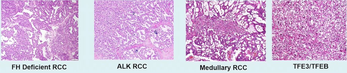 The sharks are aggressive/metastatic cancers: