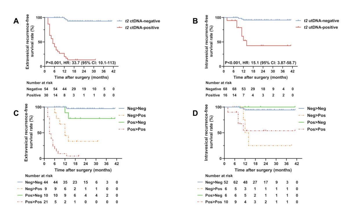This escalated to 31.7-fold at T2 (HR 31.7, 9.5–106.1; p < 0.001), while T2 utDNA positivity predicted intravesical recurrence (HR 14.5, 3.7–56.5; p < 0.001). Site-specific recurrence associations and dynamic monitoring of ctDNA and utDNA is shown in the following figure: