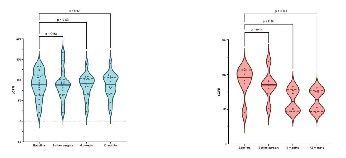 At 1 year, the kidney-sparing group (n= 14) exhibited a median improvement in eGFR from baseline (+3.6%), contrasting with a median decline of 29.8% in the radical nephroureterectomy group (n = 5):