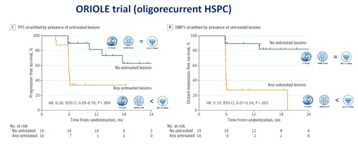 Does PSMA PET imaging make a difference? In the ORIOLE trial,2 all patients received conventional imaging, and PSMA PET/CT, and physicians were blinded to the PSMA result. In the following Kaplan-Meier curves for composite progression-free survival (HR 0.26, 95% CI 0.09-0.76) and distant metastasis-free survival (HR 0.19, 95% CI 0.07-0.54), no untreated lesions had significantly improved outcomes compared to any untreated lesions: