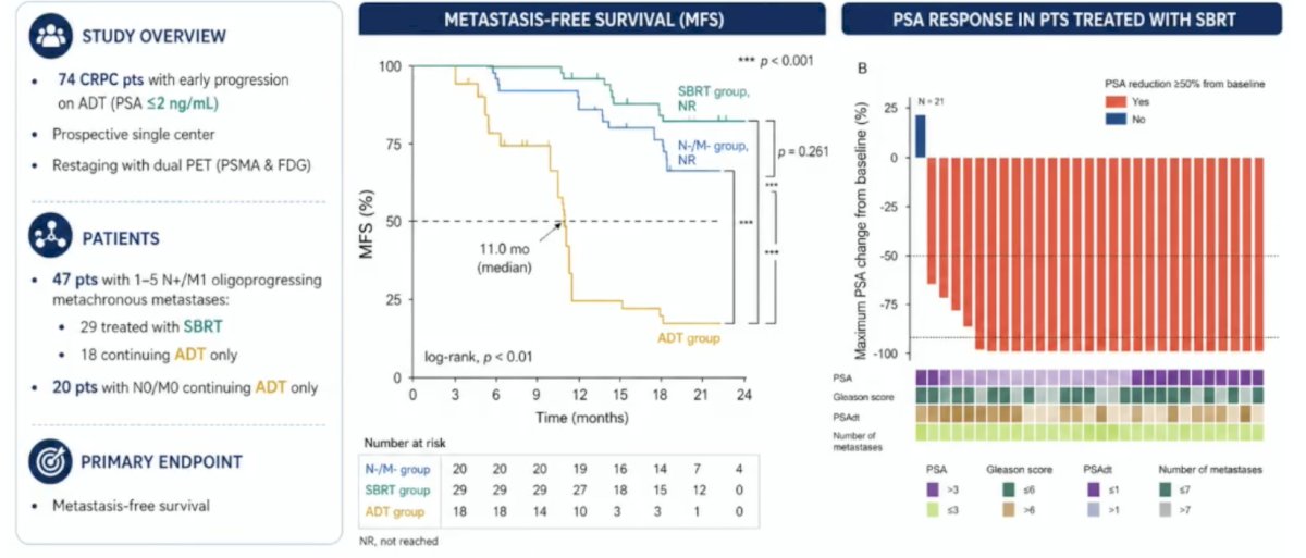 Overall, 54 patients had metastases, and 17/54 (32%) had PET-discordant PSMA-/FDG+ disease.&nbsp;&nbsp;With the use of dual tracers for staging, PSA response >90% was achieved by 86% of the patients receiving stereotactic body radiotherapy. Notably, patients receiving stereotactic body radiotherapy had superior metastasis-free survival, compared to patients continuing ADT (11 versus 4.7 months,&nbsp;p < 0.001):