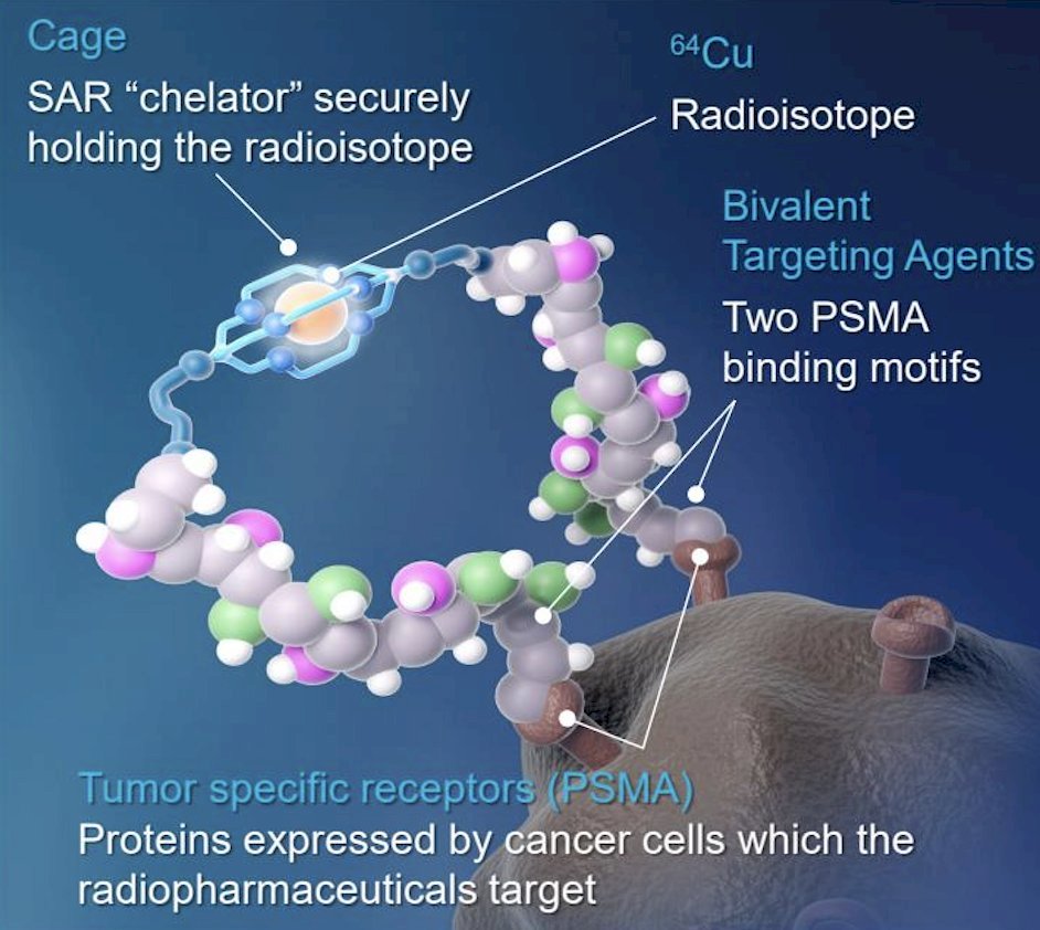 Prostate cancer is the second most prevalent cancer in men globally, and there is a need for improved prostate cancer imaging, reflected in a biochemical recurrence rate of 20 to 40% after initial definitive therapy.1,2 Despite advances in technology, many patients will fail to have their recurrence accurately localized by imaging, especially at low PSA levels. Imaging modalities that are widely available and can accurately detect, monitor, and restage residual / recurrent loco-regional and metastatic disease are therefore highly desirable. &nbsp;PSMA is a type II transmembrane glycoprotein that is strongly overexpressed in prostate cancer, making it an ideal target for imaging and therapy. 64Cu-SAR-bisPSMA may offer several advantages over the currently approved PSMA PET agents for prostate cancer due to the bivalent structure of SAR-bisPSMA and longer half-life of 64Cu (t1/2 = 12.7 hours), compared to the approved monovalent PSMA agents utilizing 18F and 68Ga (t1/2 < 2 hours):