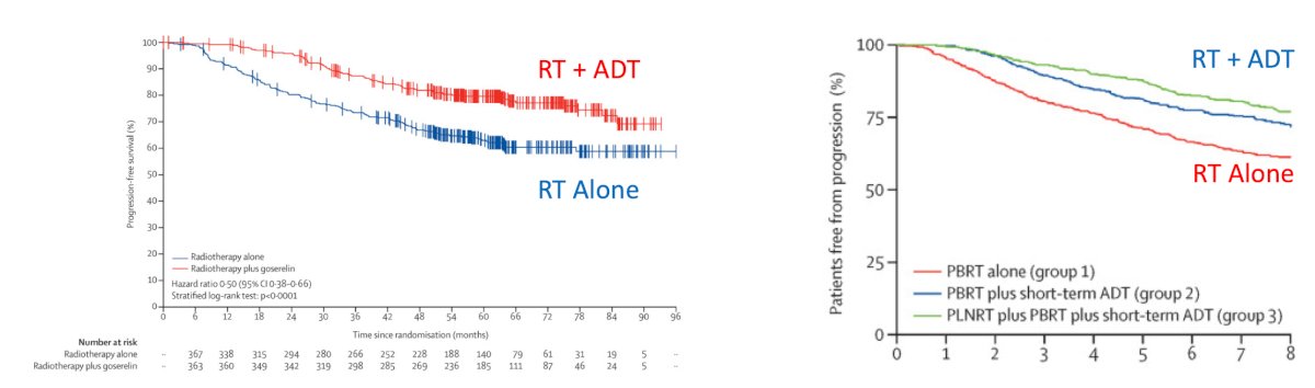 ADT is not required for all patients. In GETUG-16, approximately 50% of patients treated with radiation alone remained recurrence-free at 10 years, while in SPPORT, approximately 70% remained recurrence-free at 5 years without ADT: