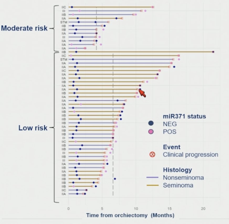 Dr. Nappi subsequently presented swimmer plot analyses among patients who ultimately relapsed and had available baseline miR371 samples, further stratified according to risk group. Among low-risk patients, who were predominantly composed of CSI seminoma cases, the median time to relapse was approximately 7 months, shorter than initially anticipated. In this subgroup, the sensitivity of miR371 for relapse detection was 56%, although only 20% of low-risk patients demonstrated true-positive miR371 positivity at baseline. In contrast, moderate-risk patients, primarily consisting of LVI-positive nonseminoma, experienced a substantially shorter median time to relapse of approximately 4 months. Sensitivity for relapse detection in this cohort reached 59%, with 33% of moderate-risk patients demonstrating true-positive baseline miR371 positivity.