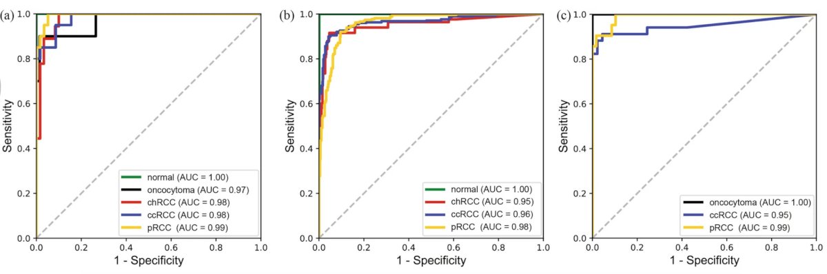 artificial intelligence classification for RCC-2.jpg