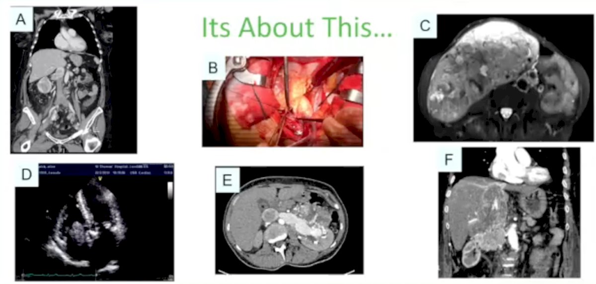 Recurrent Disease-0.jpg