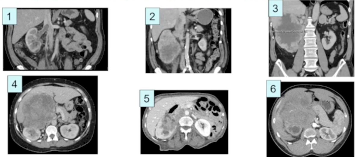 Recurrent Disease-1.jpg