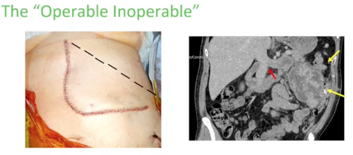 Recurrent Disease-3.jpg