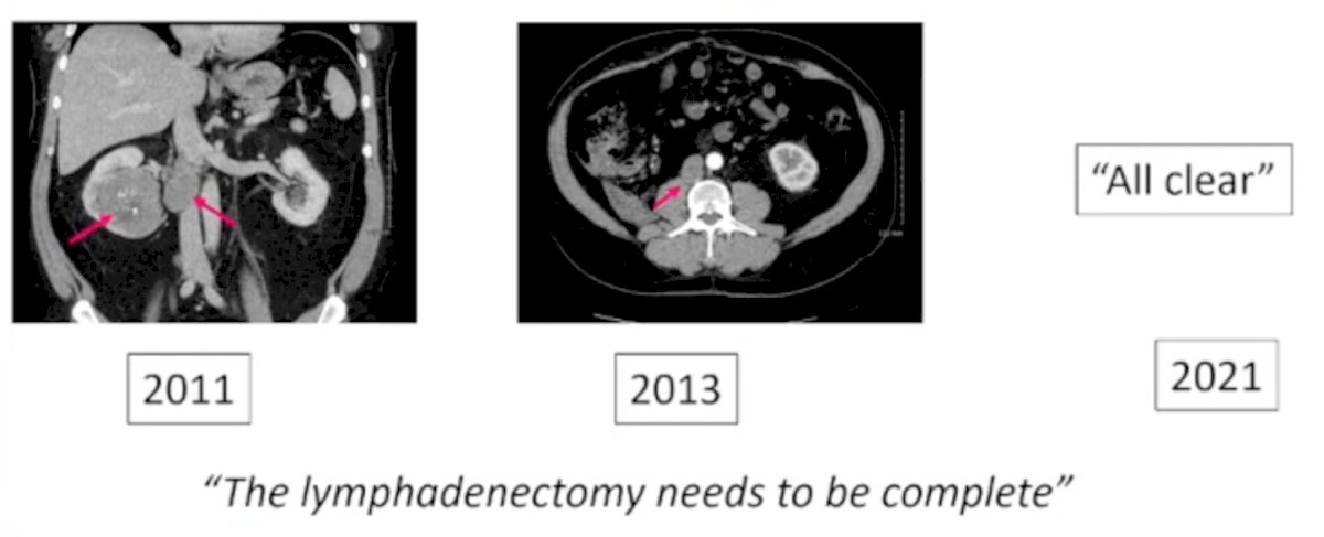 Recurrent Disease-5.jpg