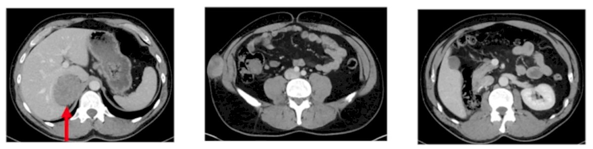Recurrent Disease-6.jpg