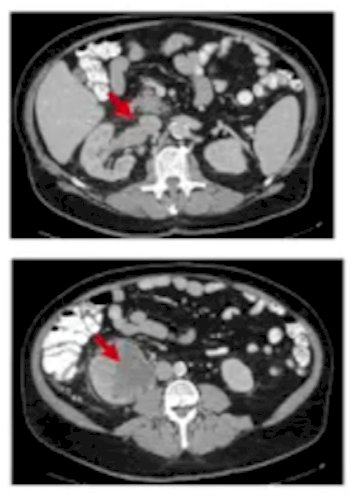 Systemic Therapy-1.jpg