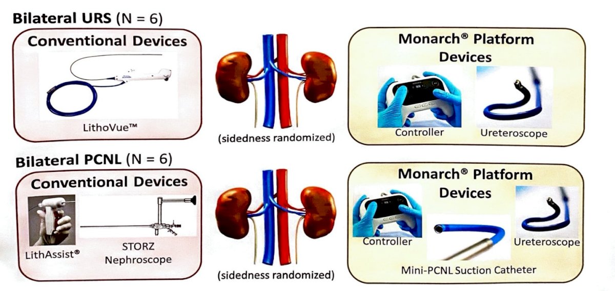 PCNL-0.jpg