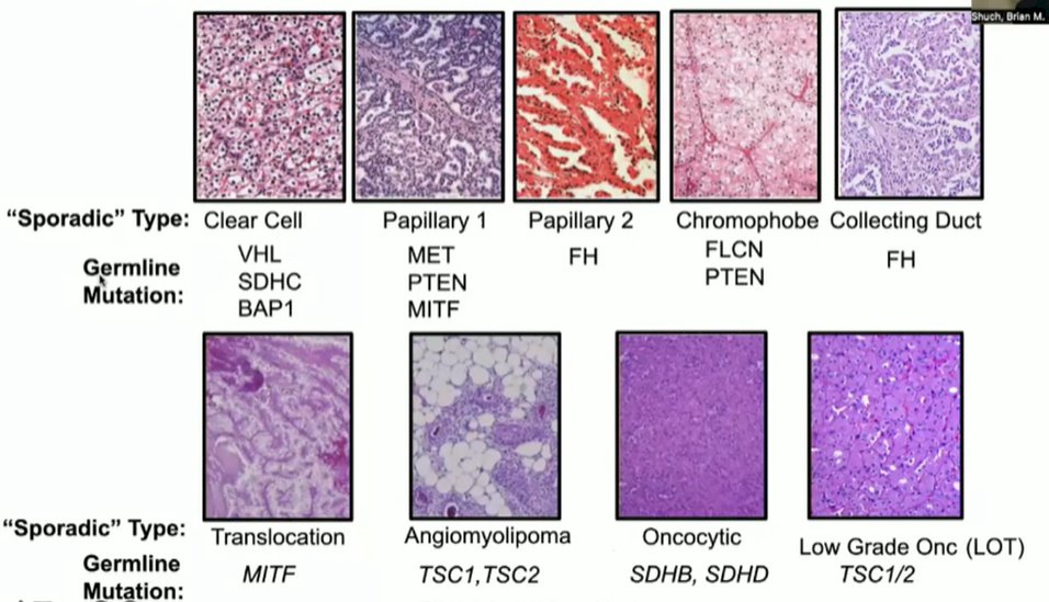 Renal Tumor.jpg