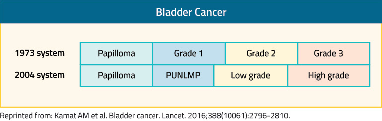 diagram-bladder-cancer@2x.jpg