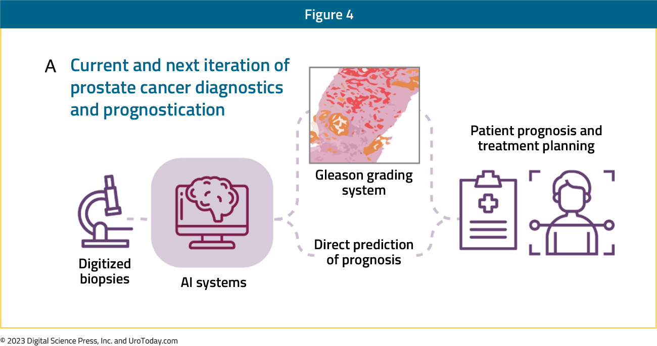 figure-4-AI-prostate-cancer2x.jpg