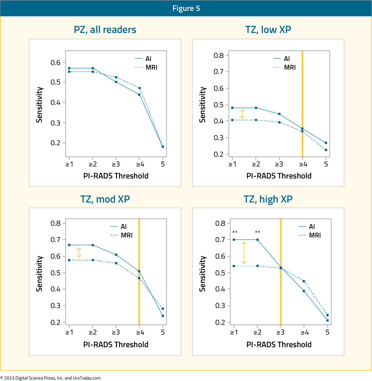figure-5-AI-prostate-cancer2x.jpg