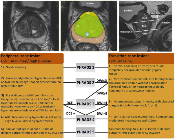 images_2_peripheal_lesion.png