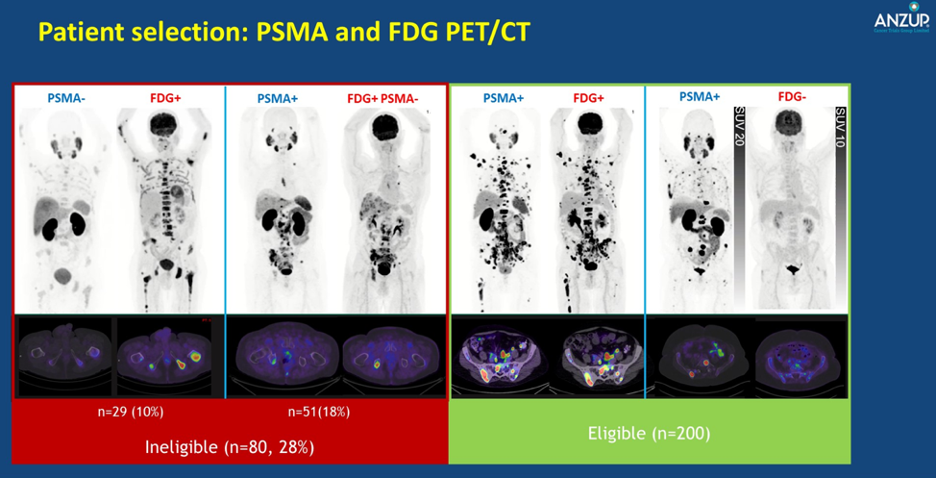 patient selection psma and fdg pet ct