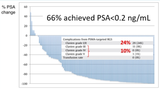 prostate cancer PSMA ligand PET