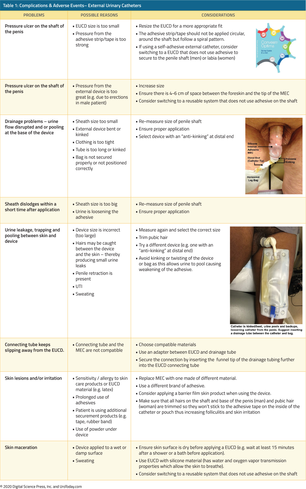 table 1 complications external urinary catheters2x